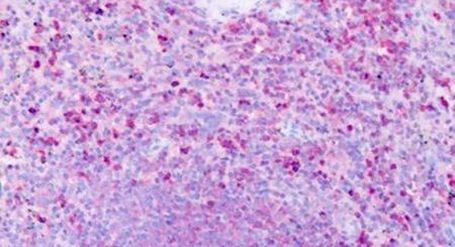 HRH1 Antibody in Immunohistochemistry (Paraffin) (IHC (P))