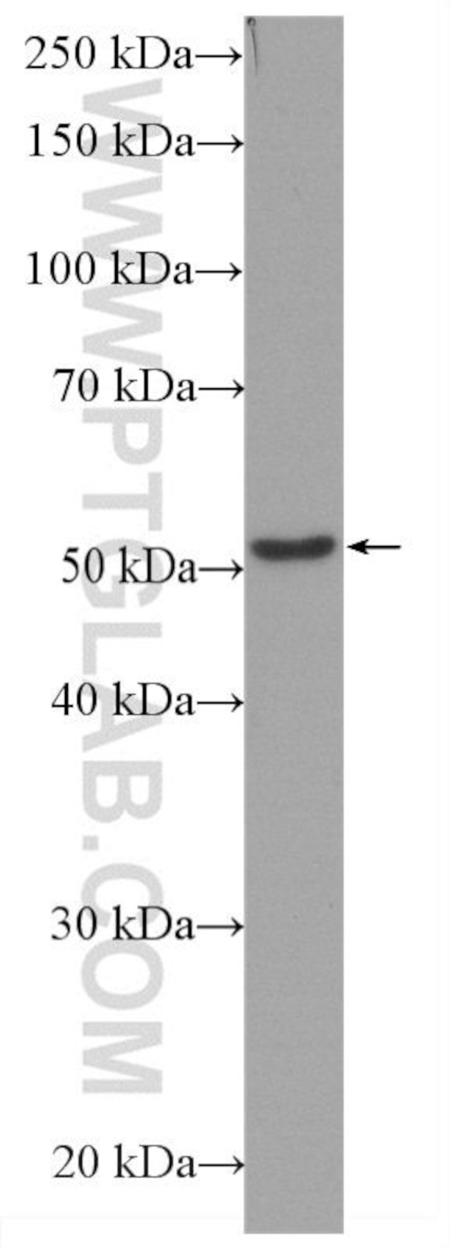 Beta Tubulin Antibody in Western Blot (WB)