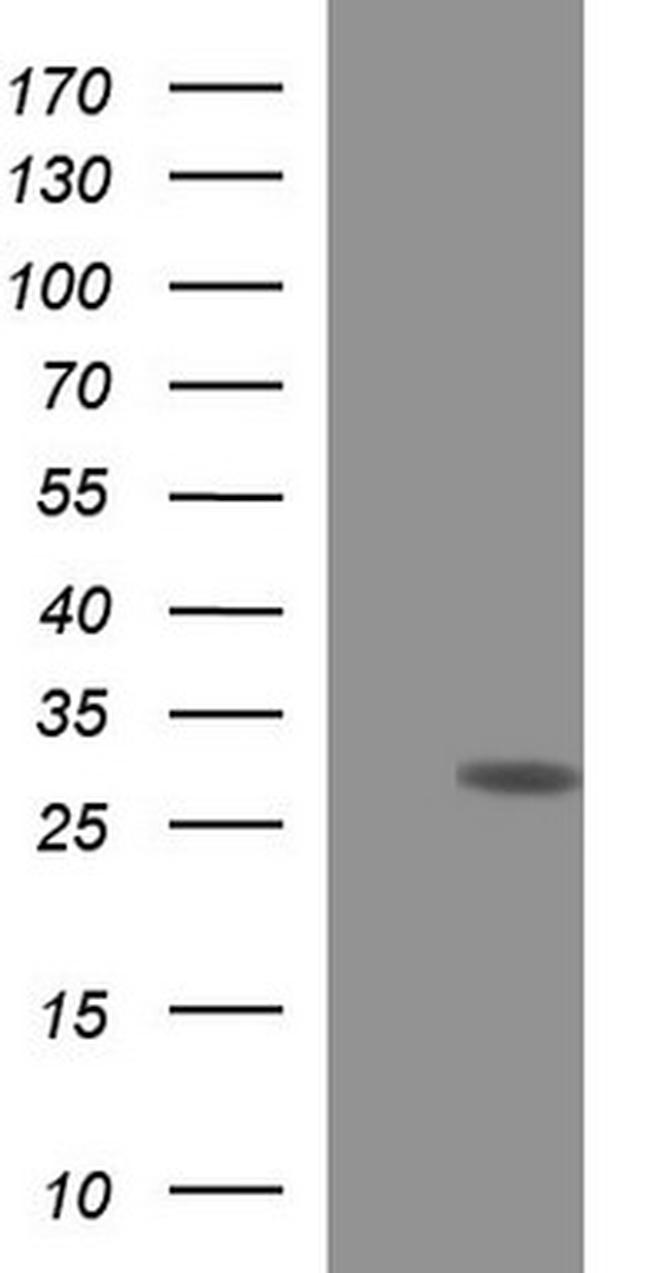 HSCB Antibody in Western Blot (WB)