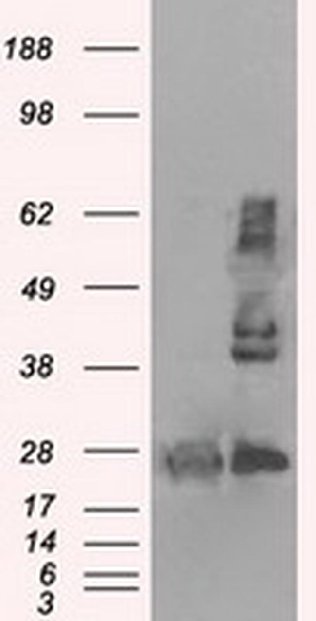 HSD17B10 Antibody in Western Blot (WB)