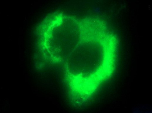 HSD17B4 Antibody in Immunocytochemistry (ICC/IF)