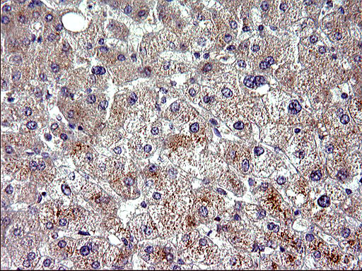 HSD17B4 Antibody in Immunohistochemistry (Paraffin) (IHC (P))