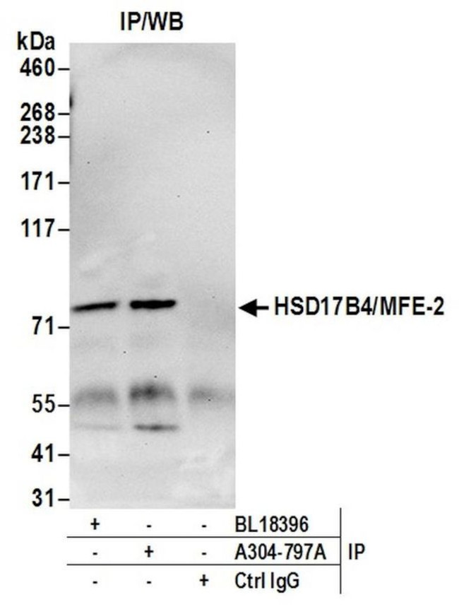 HSD17B4/MFE-2/17-beta-HSD4 Antibody in Immunoprecipitation (IP)