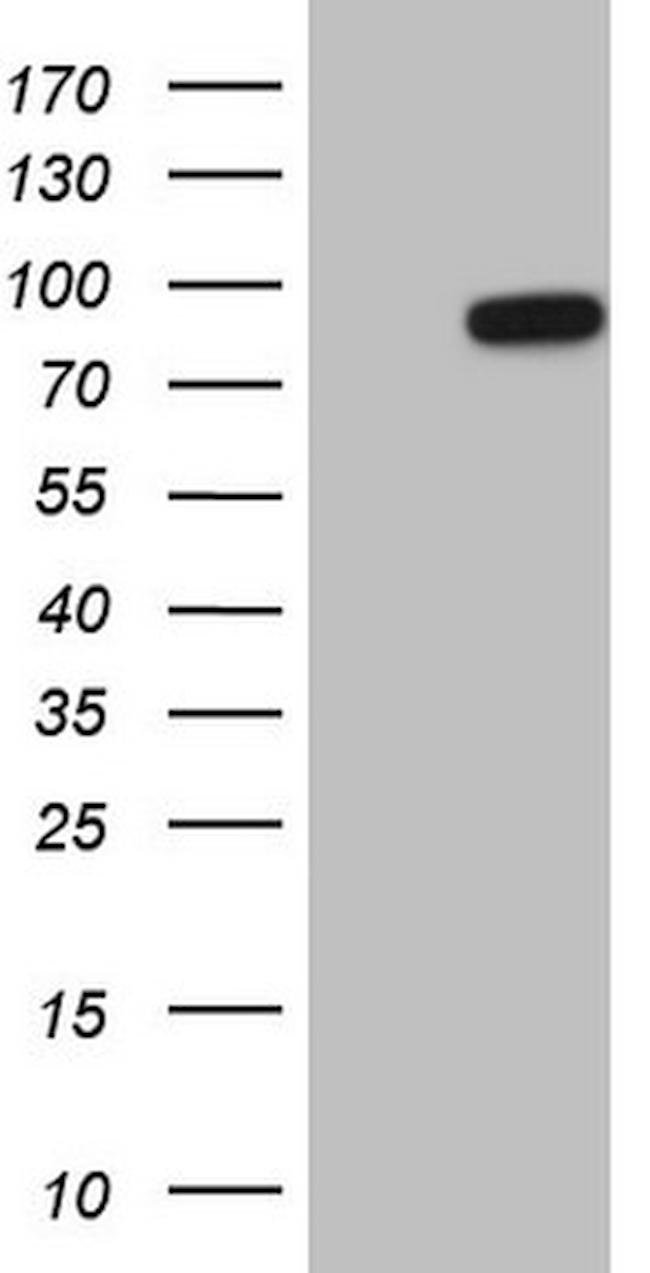 HSF2 Antibody in Western Blot (WB)