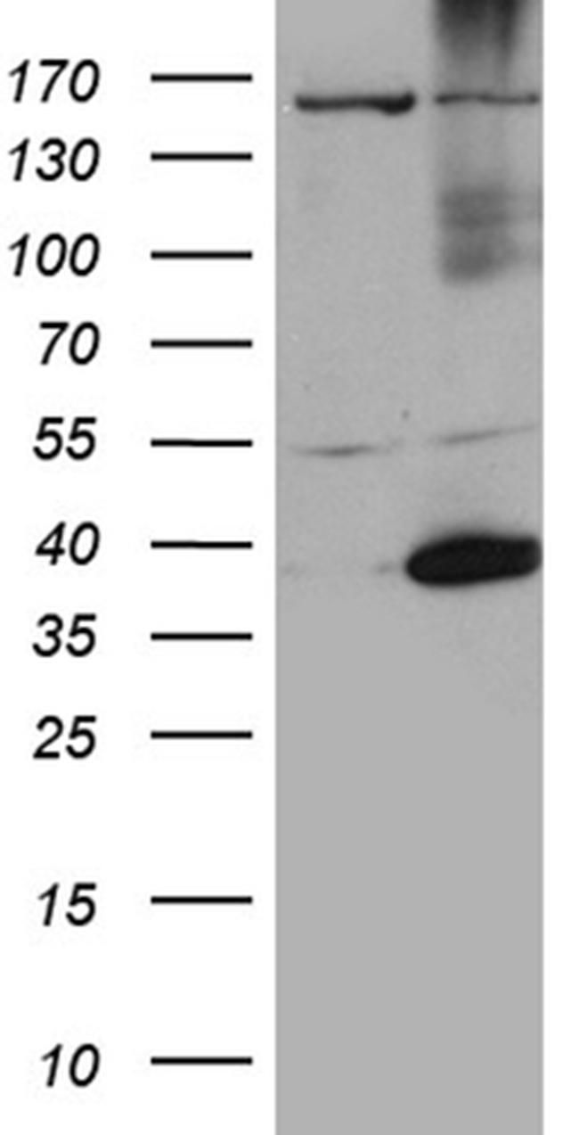 HSF2BP Antibody in Western Blot (WB)