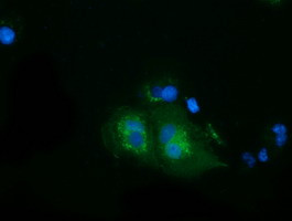 HSPA6 Antibody in Immunocytochemistry (ICC/IF)