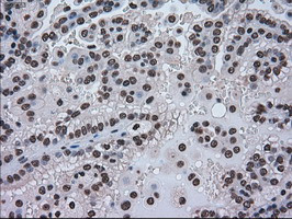 HSPA9 Antibody in Immunohistochemistry (Paraffin) (IHC (P))