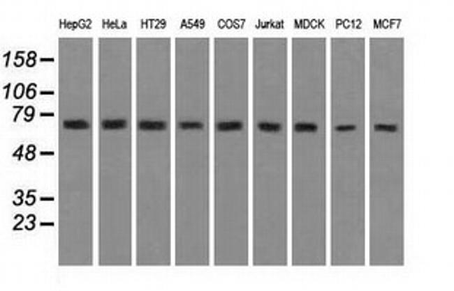 HSPA9 Antibody in Western Blot (WB)