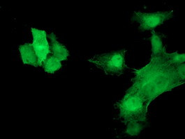 HSPB7 Antibody in Immunocytochemistry (ICC/IF)