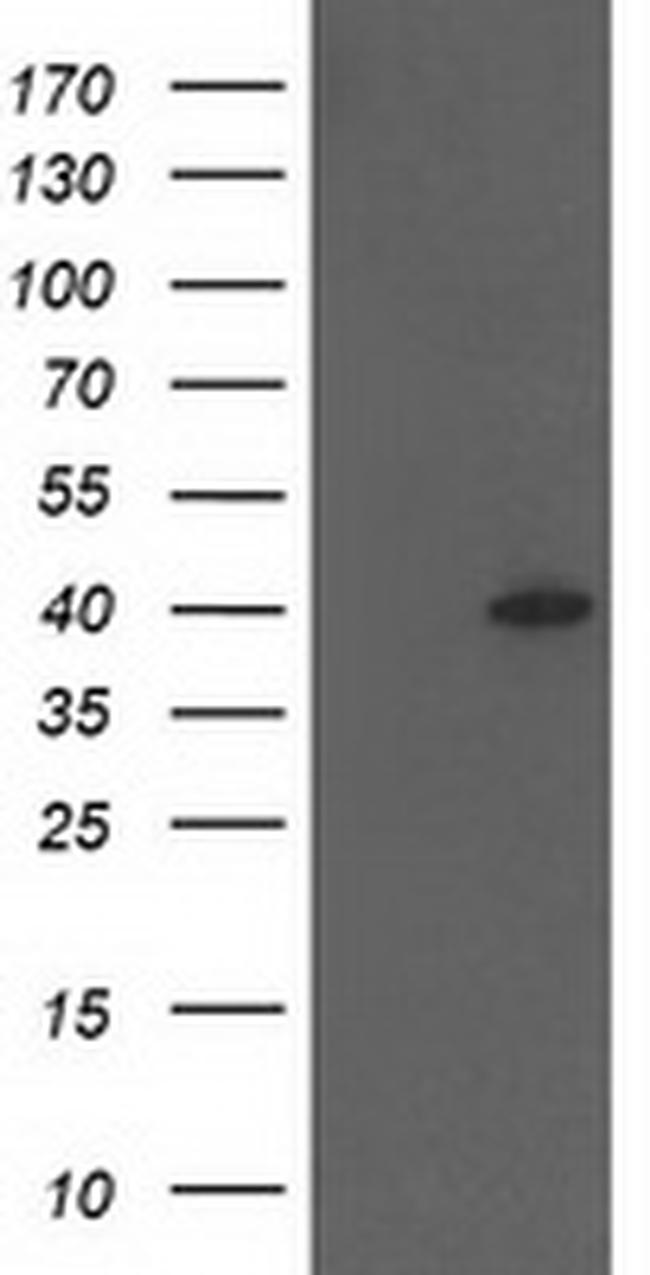 HSPBP1 Antibody in Western Blot (WB)