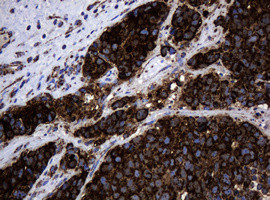 Hsp60 (HSPD1) Antibody in Immunohistochemistry (Paraffin) (IHC (P))