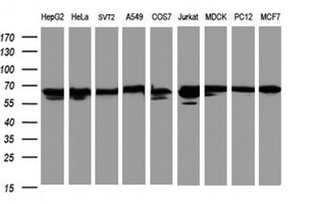 Hsp60 (HSPD1) Antibody in Western Blot (WB)