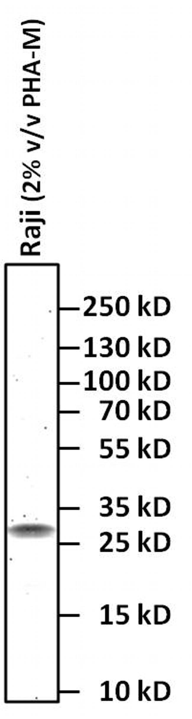 Syrian Hamster IgG (H+L) Secondary Antibody in Western Blot (WB)