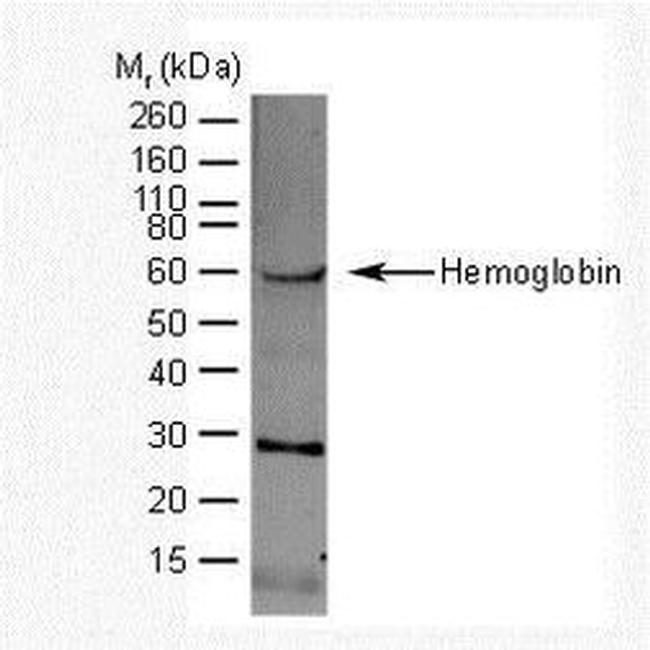 Hemoglobin Antibody in Western Blot (WB)