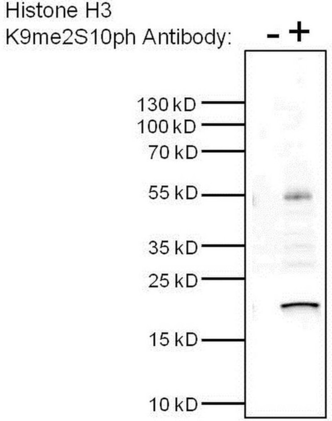 H3K9me2S10ph Antibody in Immunoprecipitation (IP)