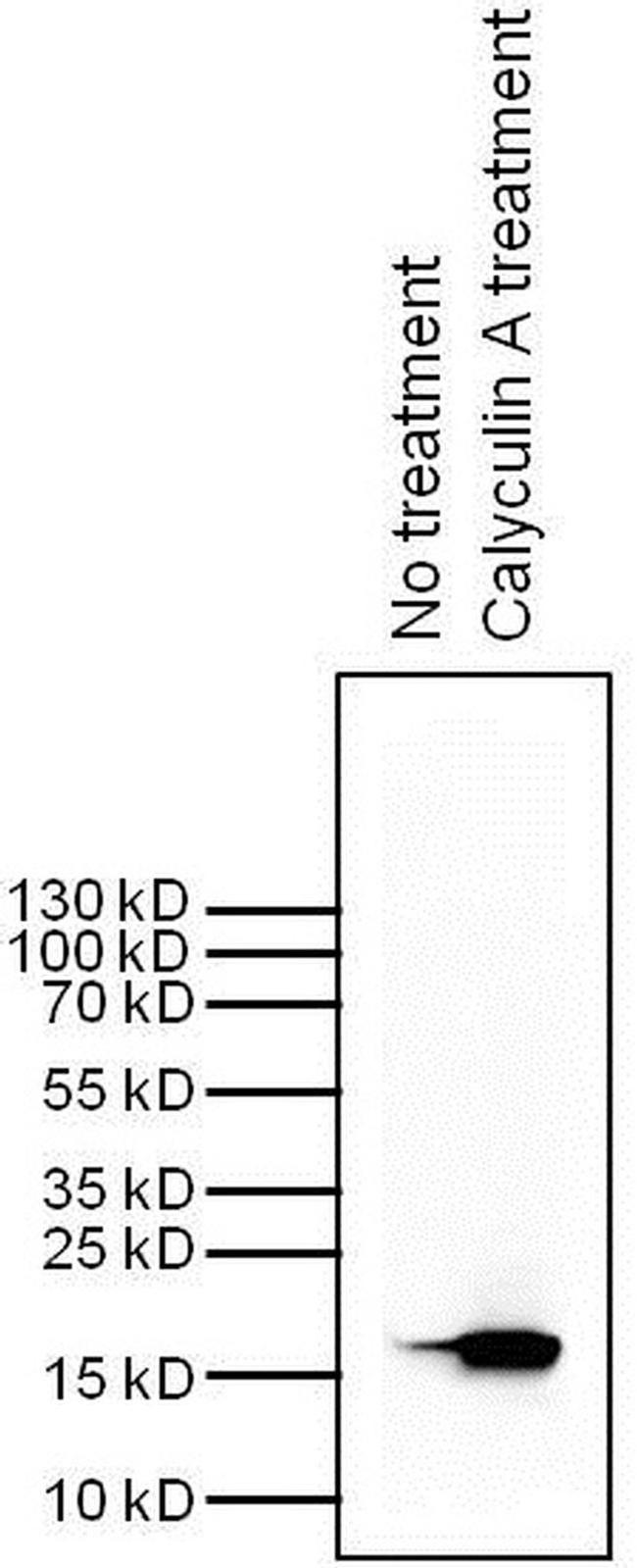 H3K9me2S10ph Antibody in Western Blot (WB)