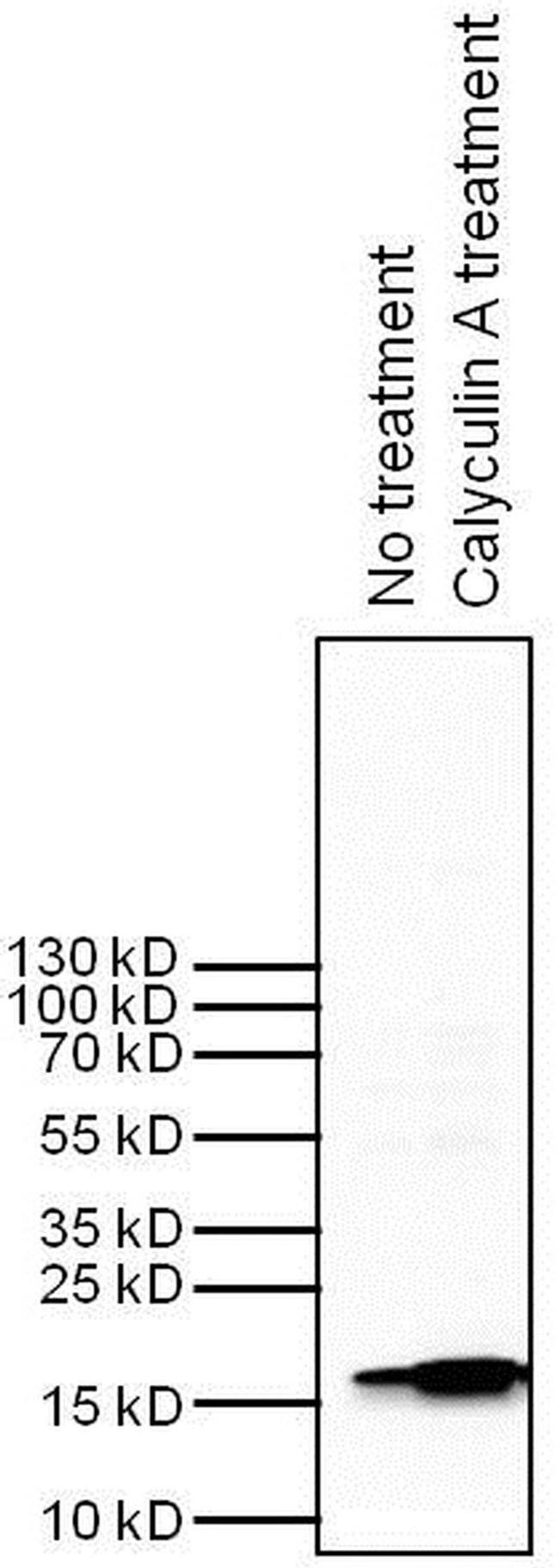 H3K9me2S10phK27me2S28ph Antibody in Western Blot (WB)