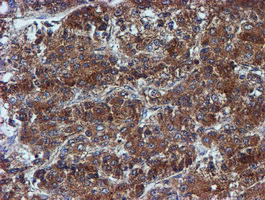 IDS Antibody in Immunohistochemistry (Paraffin) (IHC (P))