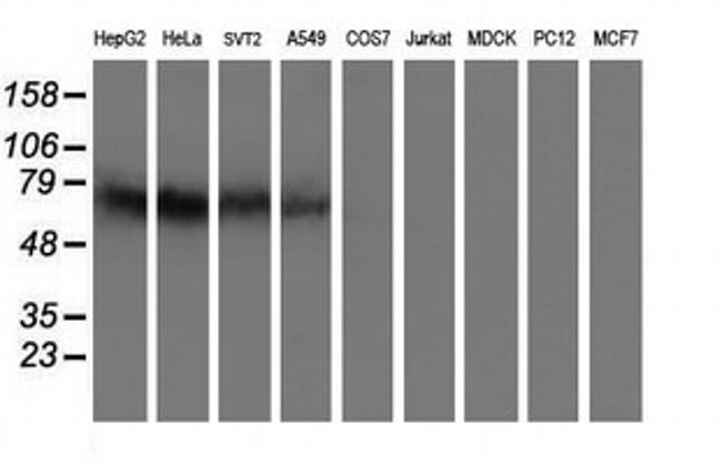 IDS Antibody in Western Blot (WB)