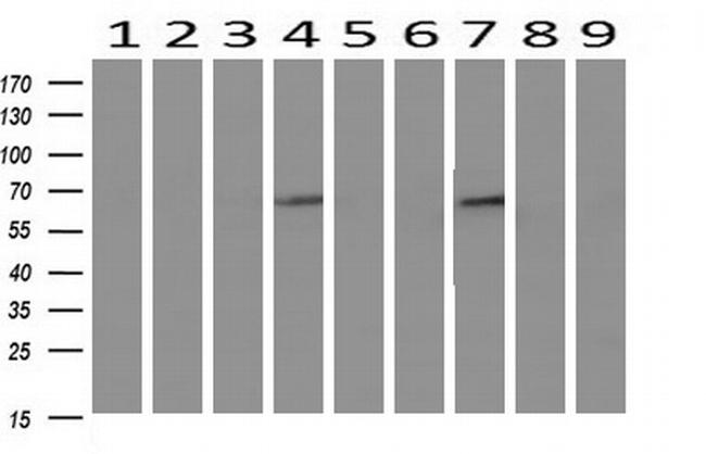 IDS Antibody in Western Blot (WB)