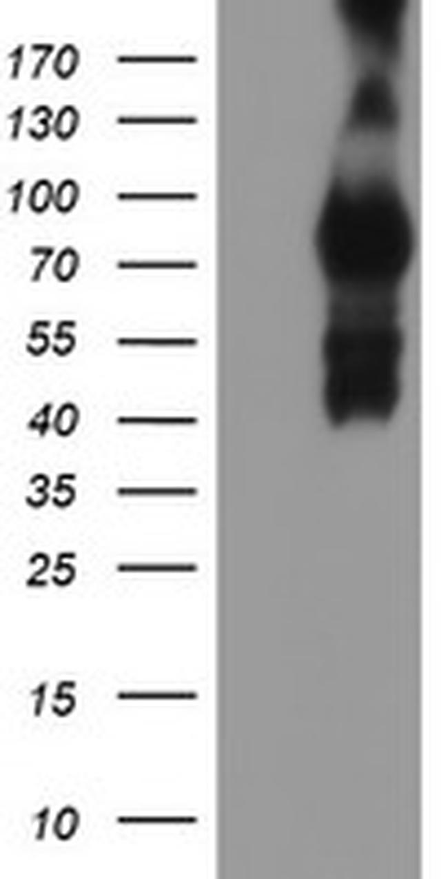 IDS Antibody in Western Blot (WB)