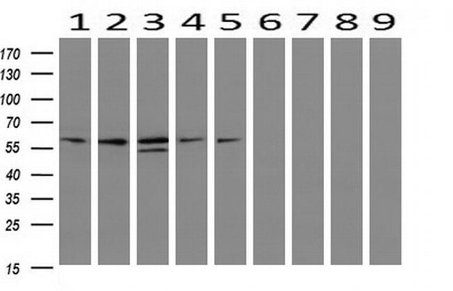 IDS Antibody in Western Blot (WB)