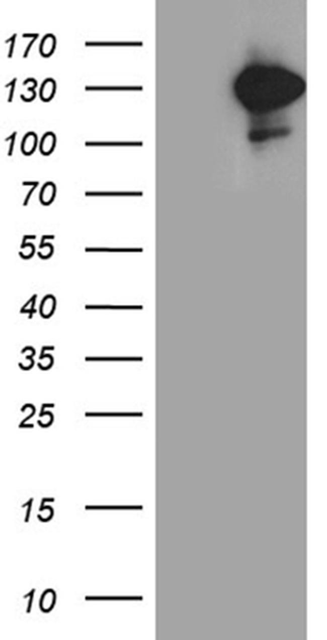 IFIH1 Antibody in Western Blot (WB)