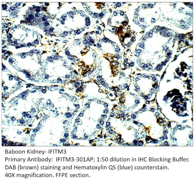 IFITM3 Antibody in Immunohistochemistry (IHC)