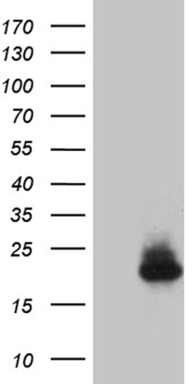 IFNA2 Antibody in Western Blot (WB)