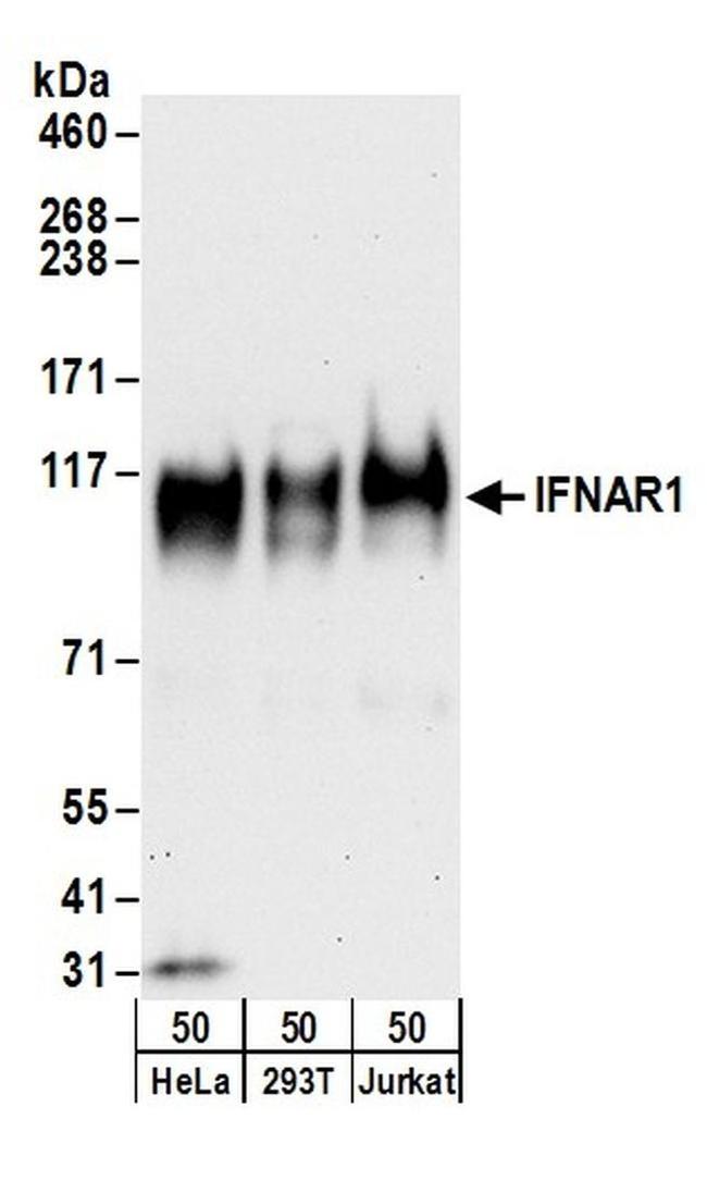 IFNAR1 Antibody in Western Blot (WB)