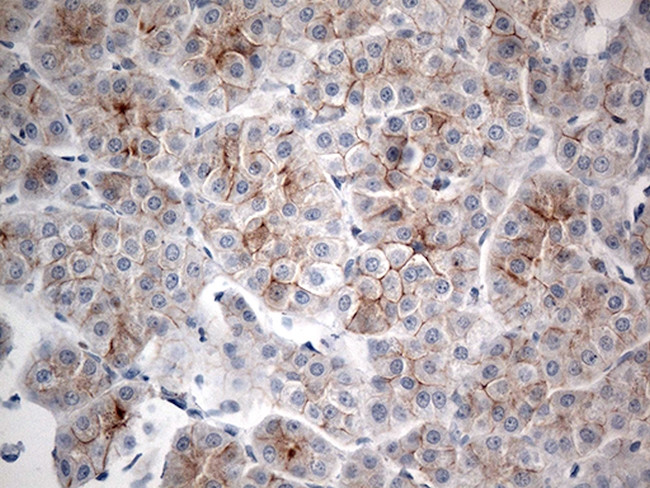 IFNLR1 Antibody in Immunohistochemistry (Paraffin) (IHC (P))