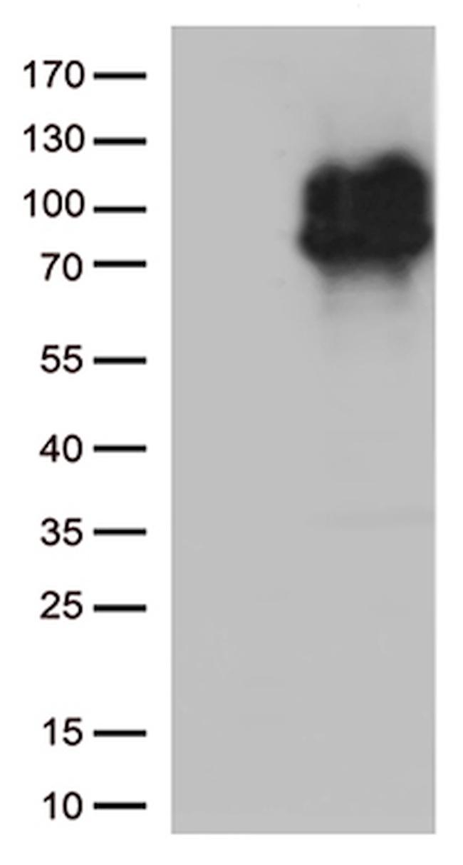 IFNLR1 Antibody in Western Blot (WB)