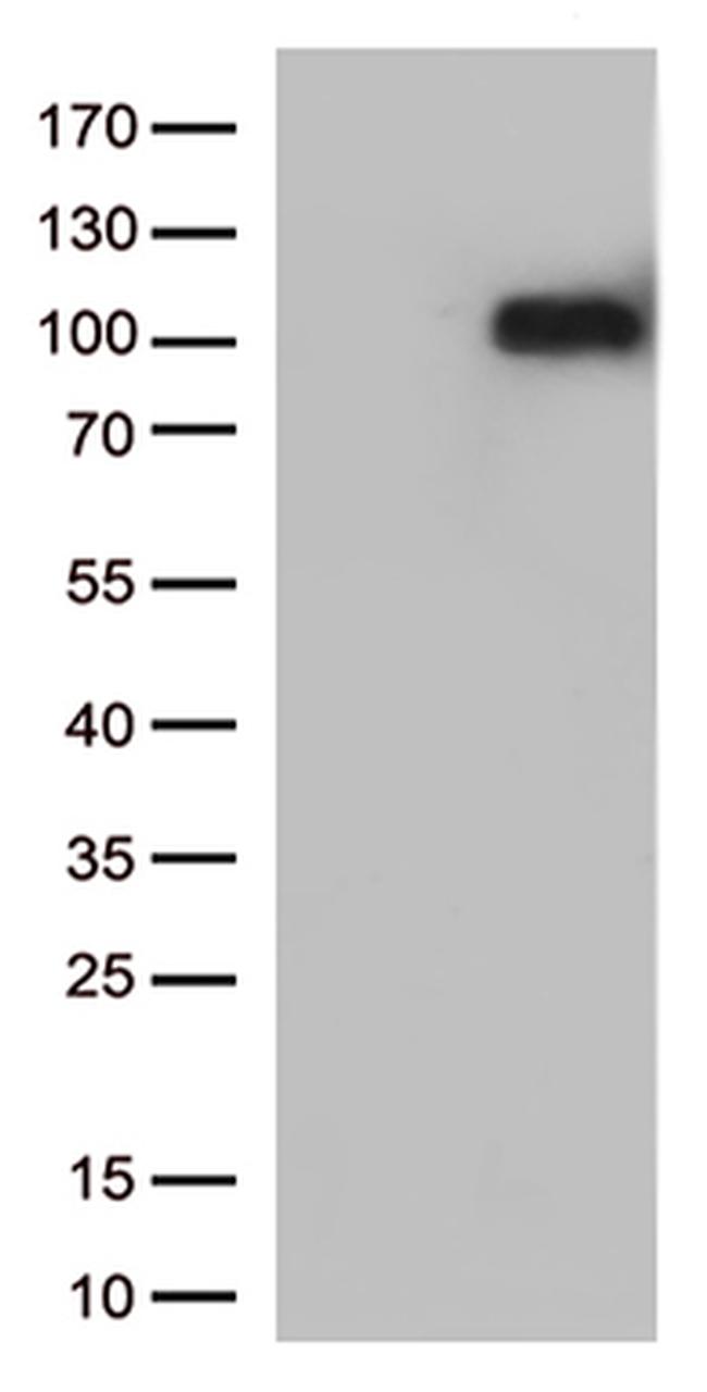 IFNLR1 Antibody in Western Blot (WB)