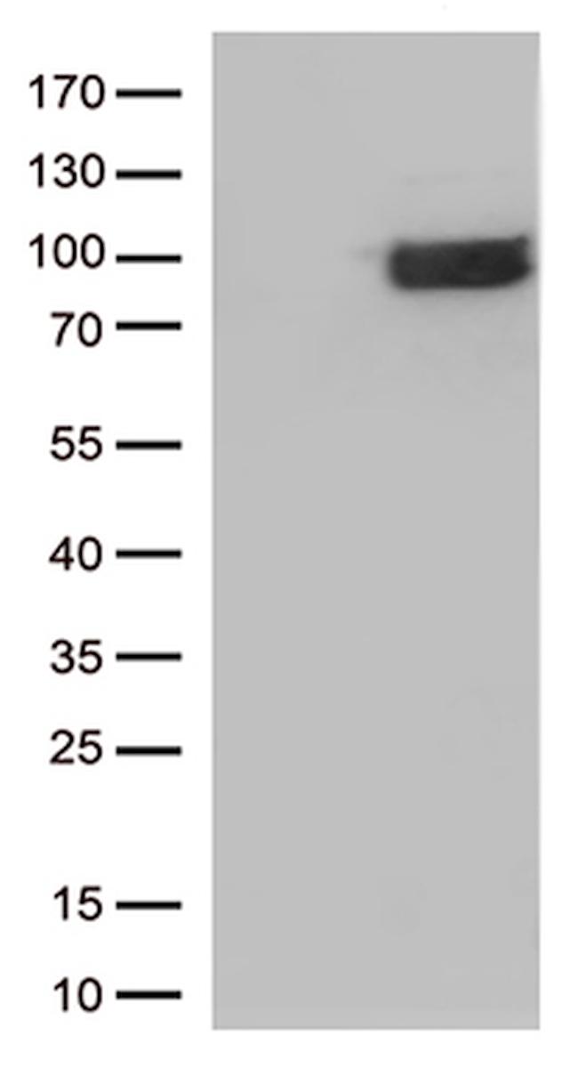 IFNLR1 Antibody in Western Blot (WB)