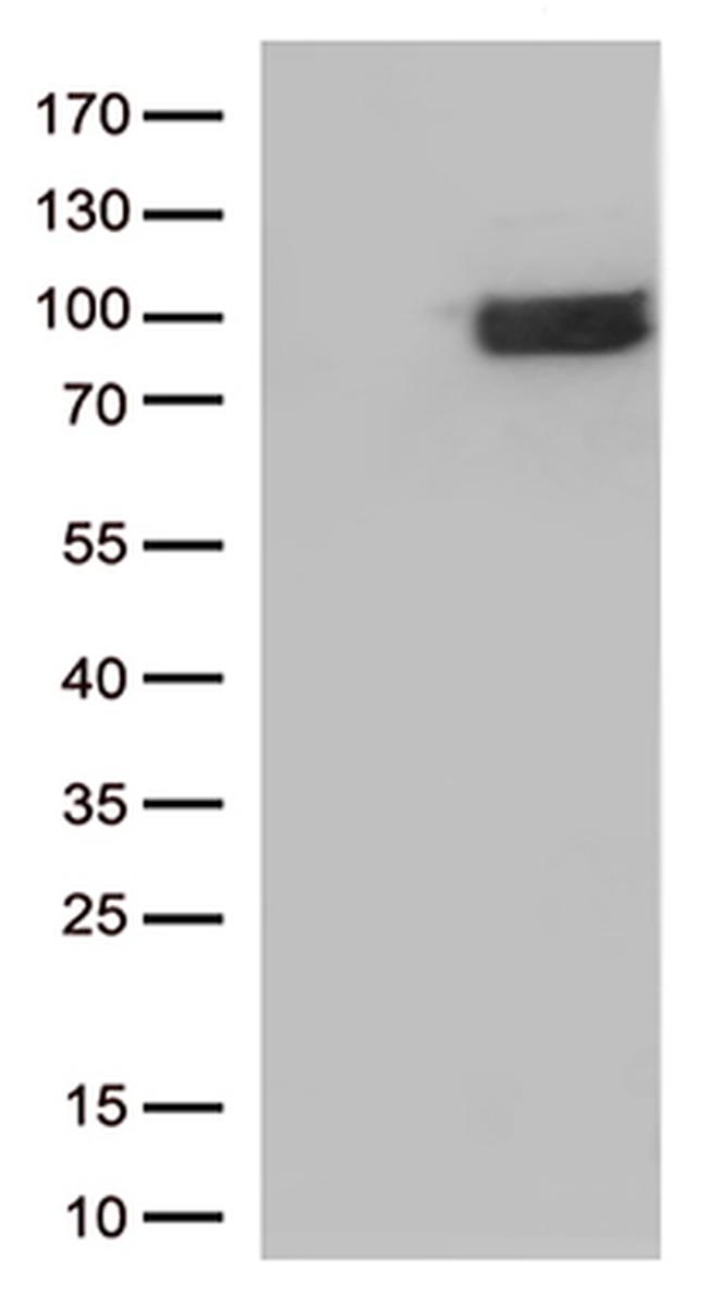 IFNLR1 Antibody in Western Blot (WB)