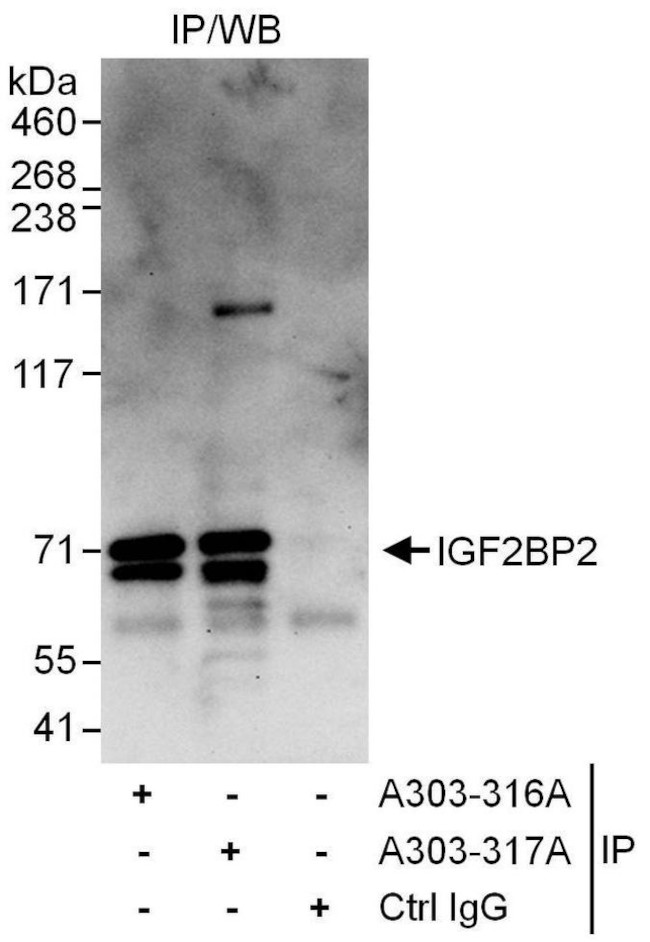 Igf2bp2 Polyclonal Antibody A303 316a T 8894
