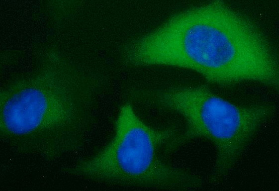 IGF2BP2 Antibody in Immunocytochemistry (ICC/IF)