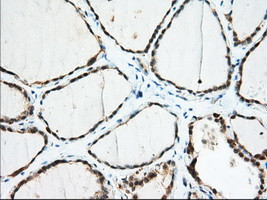 IGF2BP2 Antibody in Immunohistochemistry (Paraffin) (IHC (P))