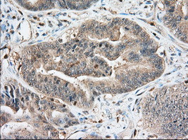 IGF2BP2 Antibody in Immunohistochemistry (Paraffin) (IHC (P))