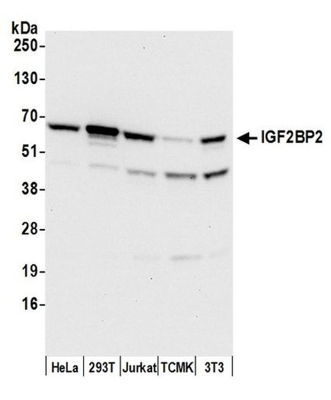 IGF2BP2 Antibody in Western Blot (WB)