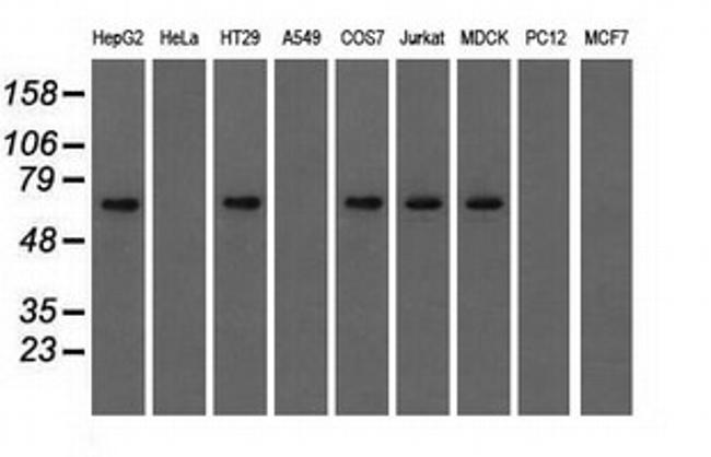 IGF2BP2 Antibody in Western Blot (WB)