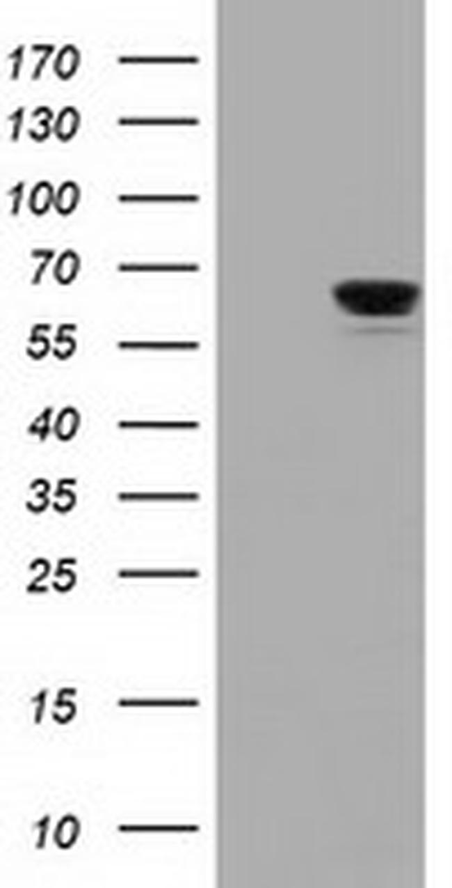 IGF2BP2 Antibody in Western Blot (WB)