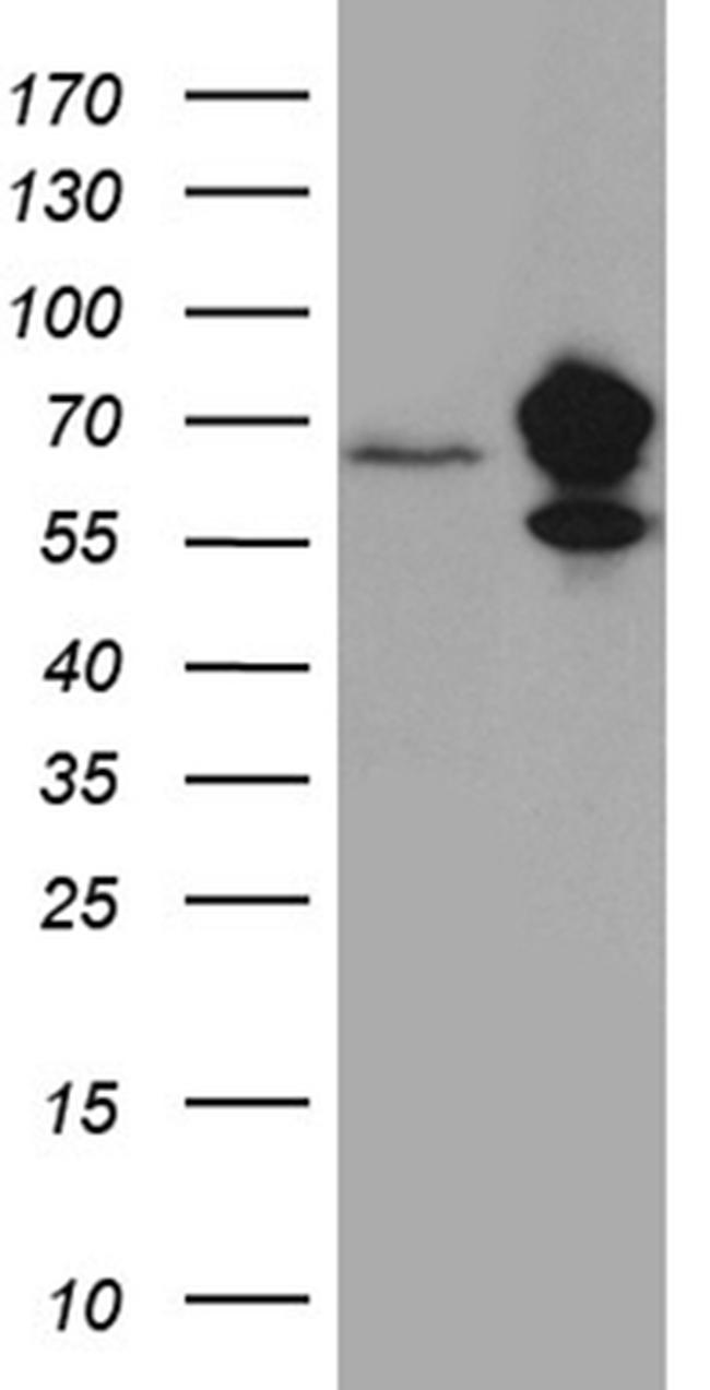 IGF2BP3 Antibody in Western Blot (WB)