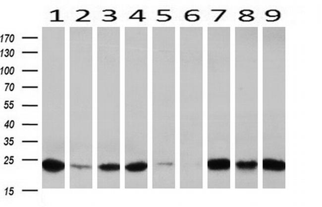 IGJ Antibody in Western Blot (WB)