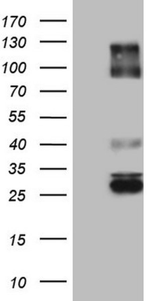 IGSF11 Antibody in Western Blot (WB)