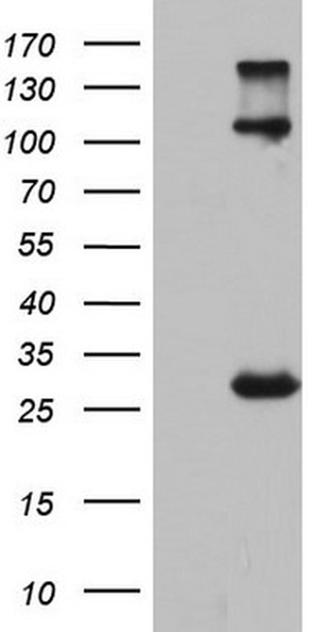 IGSF11 Antibody in Western Blot (WB)