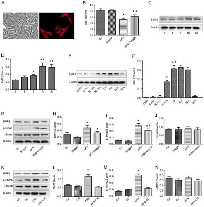 SMAD1/SMAD5/SMAD9 Antibody in Western Blot (WB)