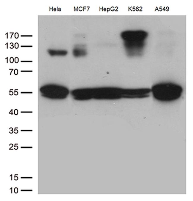 IKBKG Antibody in Western Blot (WB)