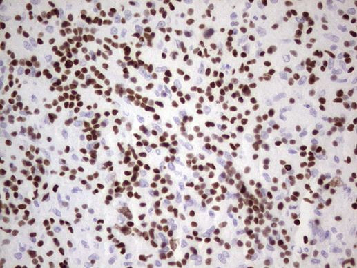 IKZF3 Antibody in Immunohistochemistry (Paraffin) (IHC (P))