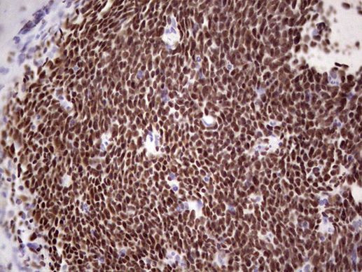 IKZF3 Antibody in Immunohistochemistry (Paraffin) (IHC (P))